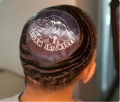 Custom Crown Patch